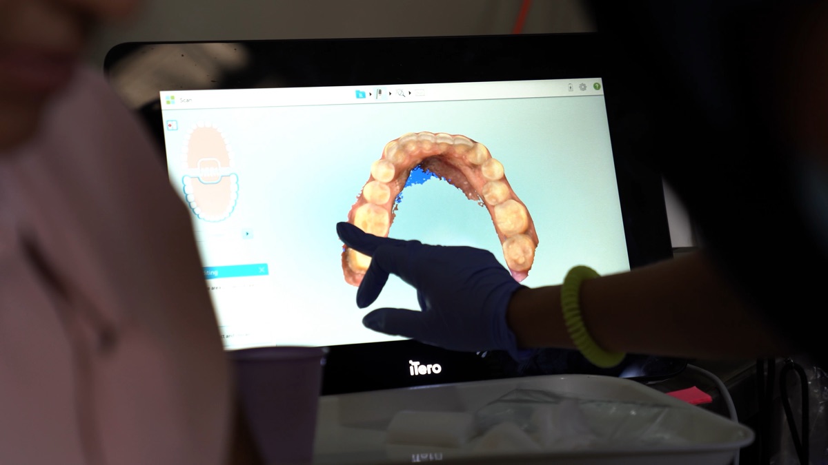 An iTero digital scan of a patient’s arch on screen at the brigade
