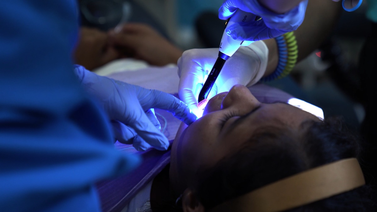 Light-curing a restoration chairside with Ivoclar materials